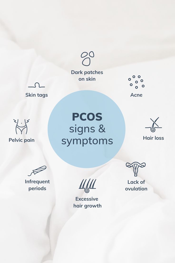 Polycystic Ovary Syndrome